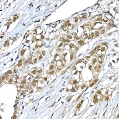 Immunohistochemistry-Paraffin SNRPD1 Antibody - Azide and BSA Free