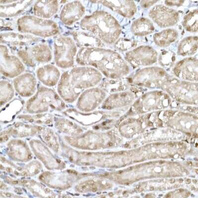 Immunohistochemistry-Paraffin SNRPD1 Antibody - Azide and BSA Free