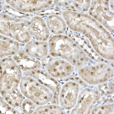 Immunohistochemistry-Paraffin: SNRPD1 Antibody [NBP2-94494] - Immunohistochemistry of paraffin-embedded rat kidney using SNRPD1 Rabbit pAb (NBP2-94494) at dilution of 1:50 (40x lens). Perform high pressure antigen retrieval with 10 mM citrate buffer pH 6.0 before commencing with IHC staining protocol.