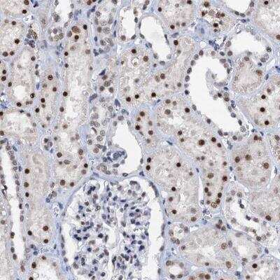 Immunohistochemistry-Paraffin SNRPD1 Antibody