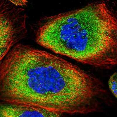 Immunocytochemistry/Immunofluorescence: SNRPD2 Antibody [NBP1-87028] - Staining of human cell line A-431 shows localization to cytosol.