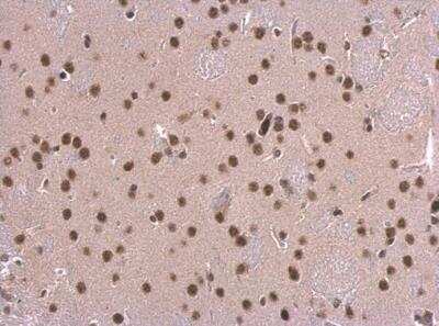 Immunohistochemistry-Paraffin: SNRPD2 Antibody [NBP2-20438] - Paraffin-embedded mouse fore brain.  SNRPD2 antibody dilution: 1:500.