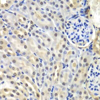 Immunohistochemistry-Paraffin: SNRPD2 Antibody [NBP2-95236] - Mouse kidney using SNRPD2 antibody at dilution of 1:100 (40x lens).