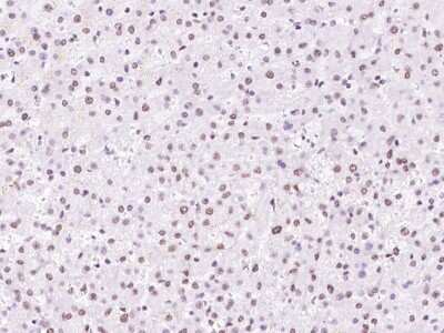Immunohistochemistry-Paraffin: SNRPD2 Antibody [NBP2-97664] - Immunochemical staining of human SNRPD2 in human liver with rabbit polyclonal antibody at 1:300 dilution, formalin-fixed paraffin embedded sections.