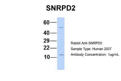 Western Blot: SNRPD2 Antibody [NBP1-57173] - Human 293T, Antibody Dilution: 1.0 ug/ml SNRPD2 is supported by BioGPS gene expression data to be expressed in HEK293T.