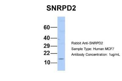 Western Blot: SNRPD2 Antibody [NBP1-57173] - Human MCF7, Antibody Dilution: 1.0 ug/ml SNRPD2 is supported by BioGPS gene expression data to be expressed in MCF7.