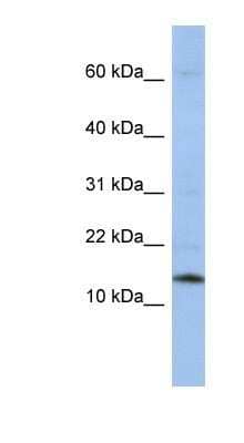 Western Blot: SNRPD2 Antibody [NBP1-57174] - HepG2 cell lysate, concentration 0.2-1 ug/ml.