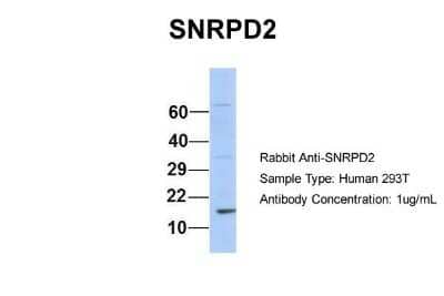 Western Blot: SNRPD2 Antibody [NBP1-57174] - Human 293T, Antibody Dilution: 1.0 ug/ml SNRPD2 is supported by BioGPS gene expression data to be expressed in HEK293T.