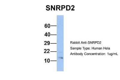 Western Blot: SNRPD2 Antibody [NBP1-57174] - Human Hela, Antibody Dilution: 1.0 ug/ml SNRPD2 is supported by BioGPS gene expression data to be expressed in HeLa.