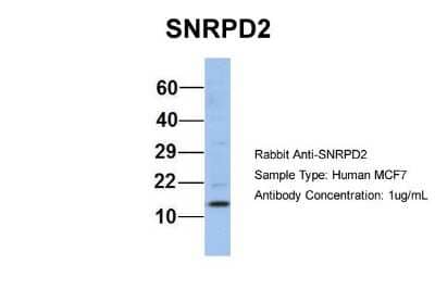 Western Blot: SNRPD2 Antibody [NBP1-57174] - Human MCF7, Antibody Dilution: 1.0 ug/ml SNRPD2 is supported by BioGPS gene expression data to be expressed in MCF7.