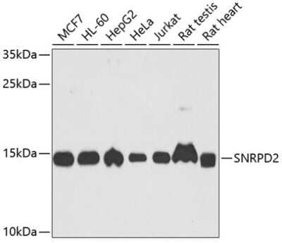 Western Blot: SNRPD2 Antibody [NBP2-95236] - Analysis of extracts of various cell lines, using SNRPD2 at 1:1000 dilution. Secondary antibody: HRP Goat Anti-Rabbit IgG (H+L) at 1:10000 dilution. Lysates/proteins: 25ug per lane. Blocking buffer: 3% nonfat dry milk in TBST. Detection: ECL Basic Kit . Exposure time: 30s.