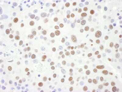 <b>Biological Strategies Validation. </b>Immunohistochemistry-Paraffin: SNRPD3 Antibody [NBP2-22306] - Sample: FFPE section of mouse renal cell carcinoma. Antibody: Affinity purified rabbit anti- Sm-D3 used at a dilution of 1:1,000 (1ug/ml). Detection: DAB. Counterstain: hematoxylin (blue).