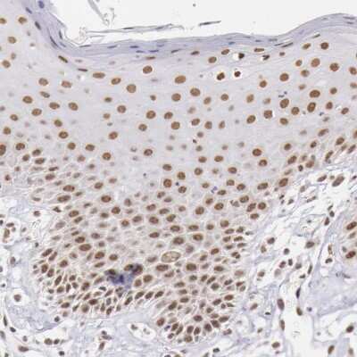 Immunohistochemistry-Paraffin SNRPD3 Antibody