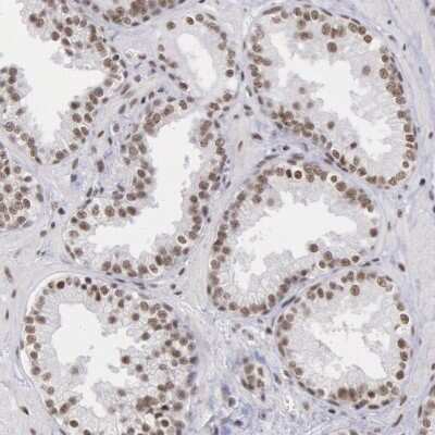 Immunohistochemistry-Paraffin: SNRPD3 Antibody [NBP1-80735] - Immunohistochemical staining of human prostate shows moderate nuclear positivity in glandular cells.