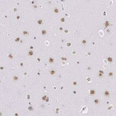 Immunohistochemistry-Paraffin: SNRPD3 Antibody [NBP1-80735] - Immunohistochemical staining of human cerebral cortex shows moderate nuclear positivity in neuronal cells.