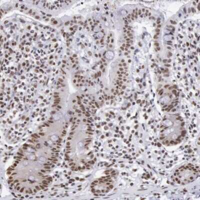 Immunohistochemistry-Paraffin: SNRPD3 Antibody [NBP1-80735] - Immunohistochemical staining of human small intestine shows moderate to strong nuclear positivity in glandular cells.