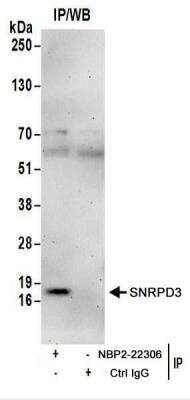 Immunoprecipitation: SNRPD3 Antibody [NBP2-22306] - Whole cell lysate (1 mg for IP; 20% of IP loaded) from HeLa cells.  NBP2-22306  used for IP at 6 ug/mg lysate.  For blotting immunoprecipitated Sm-D3, NBP2-22306 was used at 1 ug/ml.  Detection: Chemiluminescence with an exposure time of 3 minutes.