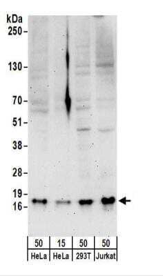 Western Blot: SNRPD3 Antibody [NBP2-22305] - Whole cell lysate from HeLa (15 and 50 ug), 293T (50 ug), and Jurkat (50 ug) cells.  NBP2-22305 used for WB at 0.4 ug/ml.  Detection: Chemiluminescence with an exposure time of 3 minutes.
