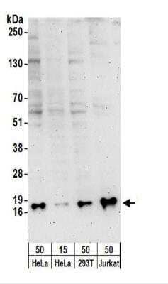 Western Blot: SNRPD3 Antibody [NBP2-22306] - Whole cell lysate from HeLa (15 and 50 ug), 293T (50 ug), and Jurkat (50 ug) cells.  NBP2-22306 used for WB at 0.4 ug/ml.  Detection: Chemiluminescence with an exposure time of 3 minutes.