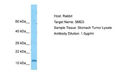Western Blot: SNRPD3 Antibody [NBP2-88323] - Host: Rabbit. Target Name: SMD3. Sample Type: Stomach Tumor lysates. Antibody Dilution: 1.0ug/ml