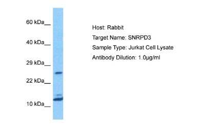 Western Blot: SNRPD3 Antibody [NBP2-88324] - Host: Rabbit. Target Name: SNRPD3. Sample Tissue: Jurkat Whole Cell lysates. Antibody Dilution: 1.0ug/ml