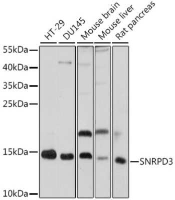 Western Blot: SNRPD3 Antibody [NBP2-93704] - Analysis of extracts of various cell lines, using SNRPD3 at 1:1000 dilution. Secondary antibody: HRP Goat Anti-Rabbit IgG (H+L) at 1:10000 dilution. Lysates/proteins: 25ug per lane. Blocking buffer: 3% nonfat dry milk in TBST. Detection: ECL Basic Kit . Exposure time: 30s.