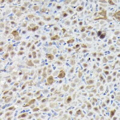 Immunohistochemistry-Paraffin: SNRPE Antibody [NBP2-94255] - Immunohistochemistry of paraffin-embedded rat ovary using SNRPE Rabbit pAb (NBP2-94255) at dilution of 1:50 (40x lens). Perform high pressure antigen retrieval with 10 mM citrate buffer pH 6.0 before commencing with IHC staining protocol.