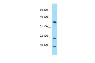 Western Blot: SNRPE Antibody [NBP2-84271] - WB Suggested Anti-SNRPE Antibody. Titration: 1.0 ug/ml. Positive Control: Hela Whole CellSNRPE is strongly supported by BioGPS gene expression data to be expressed in Human HeLa cells