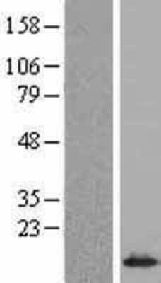 Western Blot: SNRPE Overexpression Lysate (Adult Normal) [NBL1-16292] Left-Empty vector transfected control cell lysate (HEK293 cell lysate); Right -Over-expression Lysate for SNRPE.