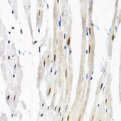 Immunohistochemistry-Paraffin: SNRPF Antibody [NBP2-93854] - Immunohistochemistry of paraffin-embedded rat heart using SNRPF Rabbit pAb (NBP2-93854) at dilution of 1:200 (40x lens). Perform high pressure antigen retrieval with 10 mM citrate buffer pH 6.0 before commencing with IHC staining protocol.