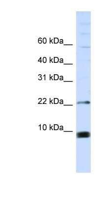 Western Blot: SNRPF Antibody [NBP1-57464] - MCF-7 whole cell lysates, concentration 0.2-1 ug/ml.