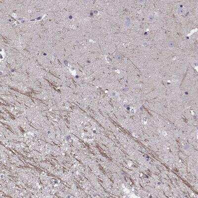 Immunohistochemistry-Paraffin SNTG1 Antibody