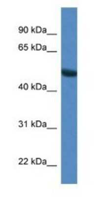 Western Blot SNTG1 Antibody