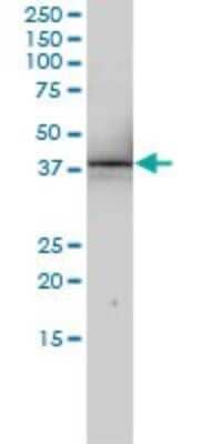 Western Blot: SNURPORTIN1 Antibody (2B2-1B4) [H00010073-M01] - RNUT1 monoclonal antibody (M01), clone 2B2-1B4 Analysis of RNUT1 expression in Jurkat.