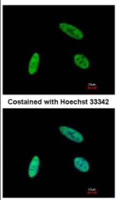 Immunocytochemistry/Immunofluorescence: SNW1 Antibody [NBP2-20440] - Immunofluorescence analysis of paraformaldehyde-fixed HeLa, using antibody at 1:500 dilution.