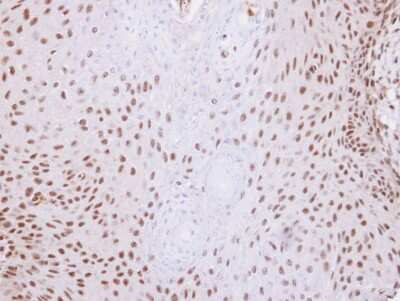 Immunohistochemistry-Paraffin: SNW1 Antibody [NBP1-31676] - Paraffin-embedded Cal27 Xenograft, using antibody at 1:100 dilution.