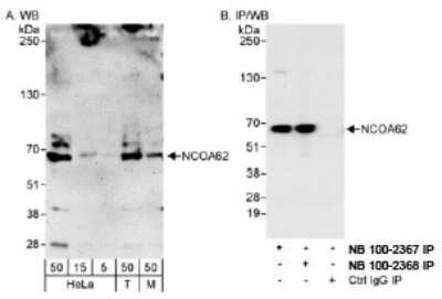 Western Blot: SNW1 Antibody [NB100-2367] - Detection of Human and Mouse NCOA62 on HeLa whole cell lysate using NB100-2367. NCOA62 was also immunoprecipitated by rabbit anti-NCOA62 antibody NB100-2368.