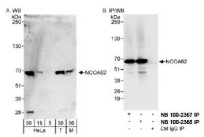 Western Blot: SNW1 Antibody [NB100-2368] - Detection of Human and Mouse NCOA62 on HeLa whole cell lysate using NB100-2368. NCOA62 was also immunoprecipitated by rabbit anti-NCOA62 antibody NB100-2367.