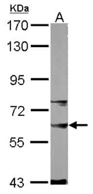 Western Blot: SNW1 Antibody [NBP1-31676] - Sample (50 ug of whole cell lysate) A: mouse liver 7. 5% SDS PAGE; antibody diluted at 1:1000.