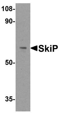 Western Blot: SNW1 Antibody [NBP1-77304] - Analysis of SkiP in mouse skeletal muscle tissue lysate with SkiP antibody at 0.5 ug/ml.