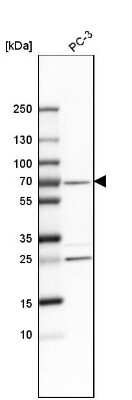 Western Blot: SNW1 Antibody [NBP1-88524] - Analysis in human cell line PC-3.