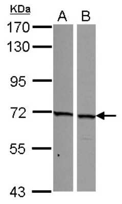 Western Blot: SNW1 Antibody [NBP2-20440] - Sample (30 ug of whole cell lysate) A: A549 B: HepG2 7. 5% SDS PAGE gel, diluted at 1:1000.