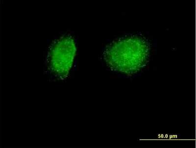 Immunocytochemistry/Immunofluorescence: SNX1 Antibody [H00006642-B02P] - Analysis of purified antibody to SNX1 on HeLa cell. (antibody concentration 10 ug/ml)