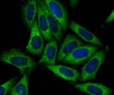 Immunocytochemistry/Immunofluorescence: SNX1 Antibody (JG40-06) [NBP2-75670] - Staining SNX1 in SiHa cells (green). The nuclear counter stain is DAPI (blue). Cells were fixed in paraformaldehyde, permeabilised with 0.25% Triton X100/PBS.