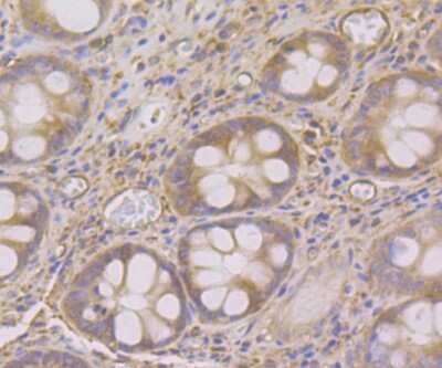 Immunohistochemistry-Paraffin: SNX1 Antibody (JG40-06) [NBP2-75670] - Analysis of paraffin-embedded human colon tissue using anti-SNX1 antibody. Counter stained with hematoxylin.