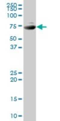 Western Blot: SNX1 Antibody [H00006642-B01P] - Analysis of SNX1 expression in human pancreas.