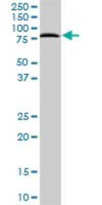 Western Blot: SNX1 Antibody [H00006642-B02P] - Analysis of SNX1 expression in A-431.