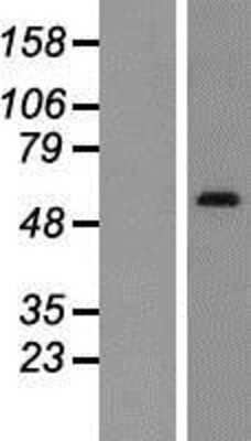 Western Blot SNX1 Overexpression Lysate