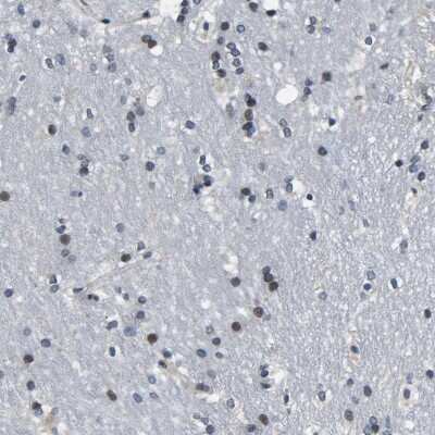 Immunohistochemistry-Paraffin: SNX10 Antibody [NBP1-86456] - Staining of human lateral ventricle shows moderate nuclear positivity in glial cells.