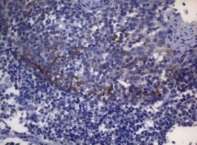 Immunohistochemistry: SNX10 Antibody (OTI6B7) - Azide and BSA Free [NBP2-74262] - Staining of paraffin-embedded Human bladder tissue within the normal limits using anti-SNX10 mouse monoclonal antibody.